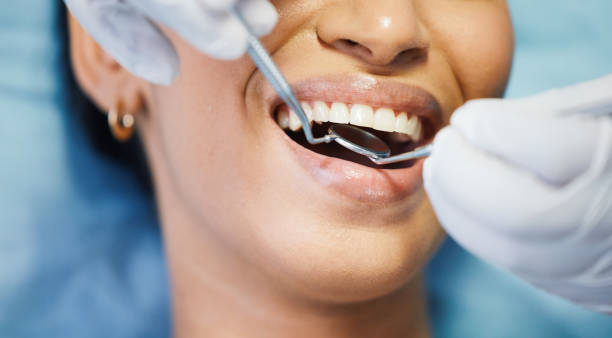 Best Emergency Dental Care for Sports Injuries in Ramblewood, NJ